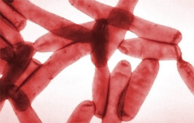 "Legionellen in rund 28% aller häuslichen Wasserversorgungsanlagen"