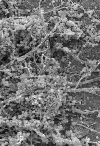 Langzeitstudie bestätigt Anti-Schimmel-Wirkung von Silikatprodukten im Innenraum