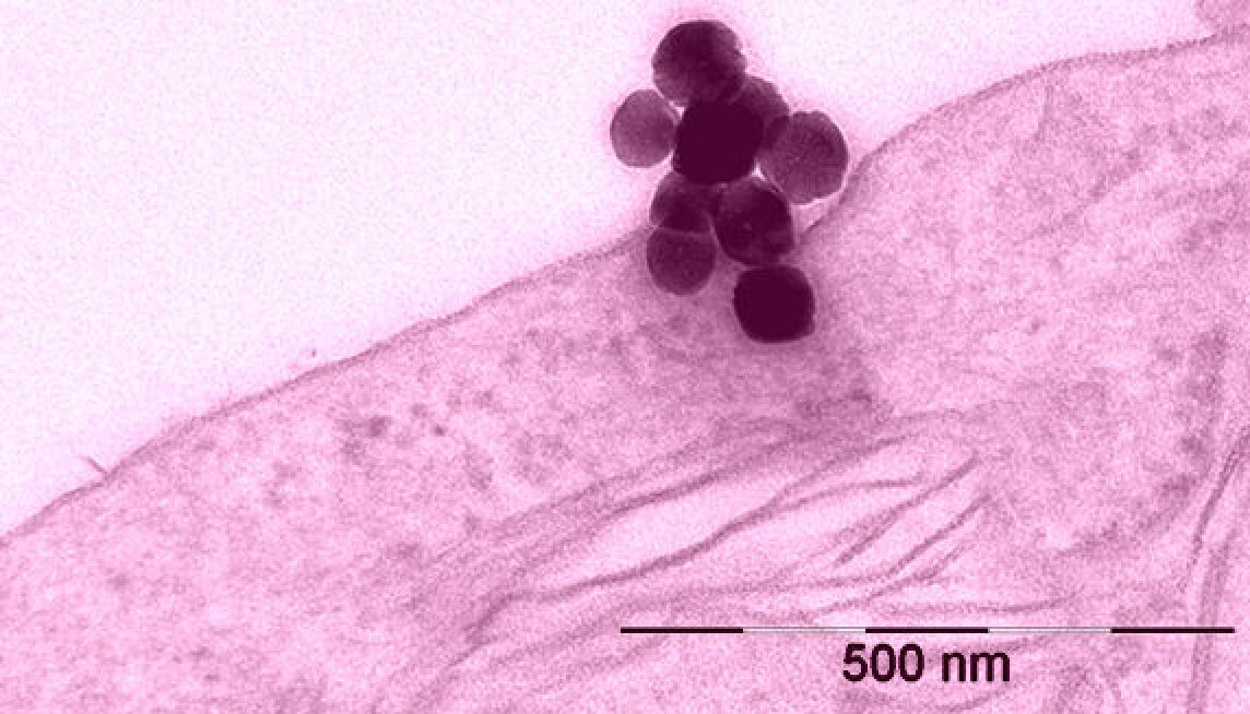 Eisenoxid-Nanopartikel